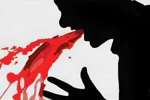 Рвота с кровью после алкоголя